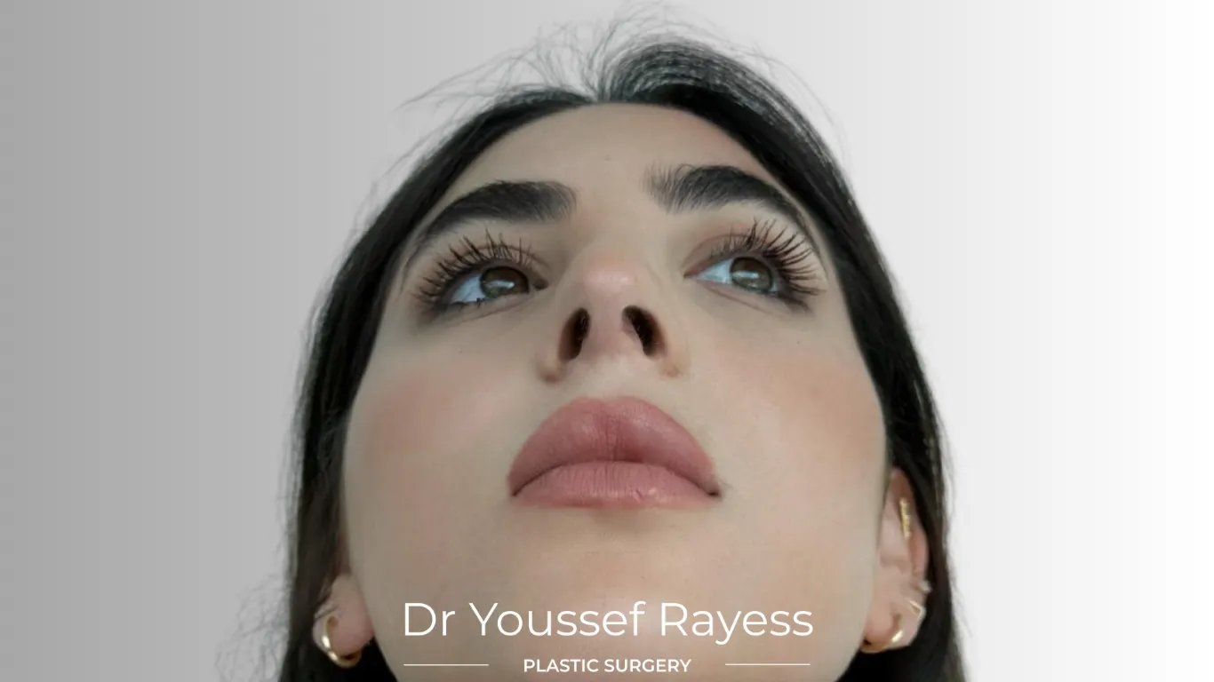 Basal view after structural rhinoplasty result by Dr Youssef Rayess in Beirut and Dubai showing natural nasal refinement and facial harmony